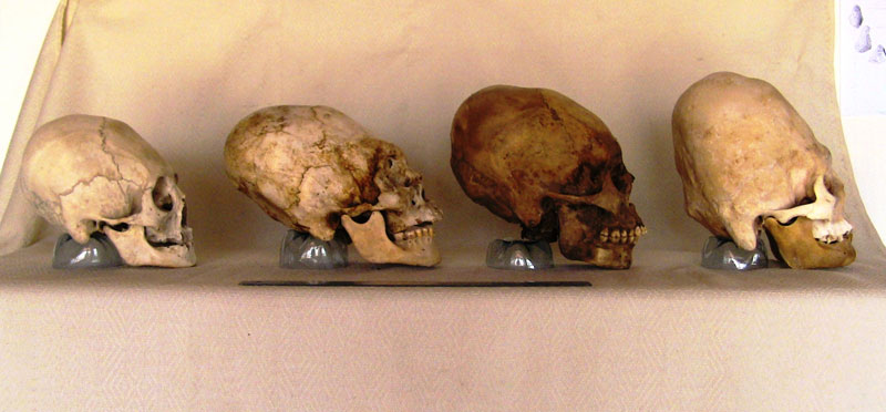 Son muchos los cráneos de este tipo que han sido encontrados, y pueden ser vistos ya que están expuestos en varios museos antropólogicos de Paracas, Ica y Pisco, en Perú.